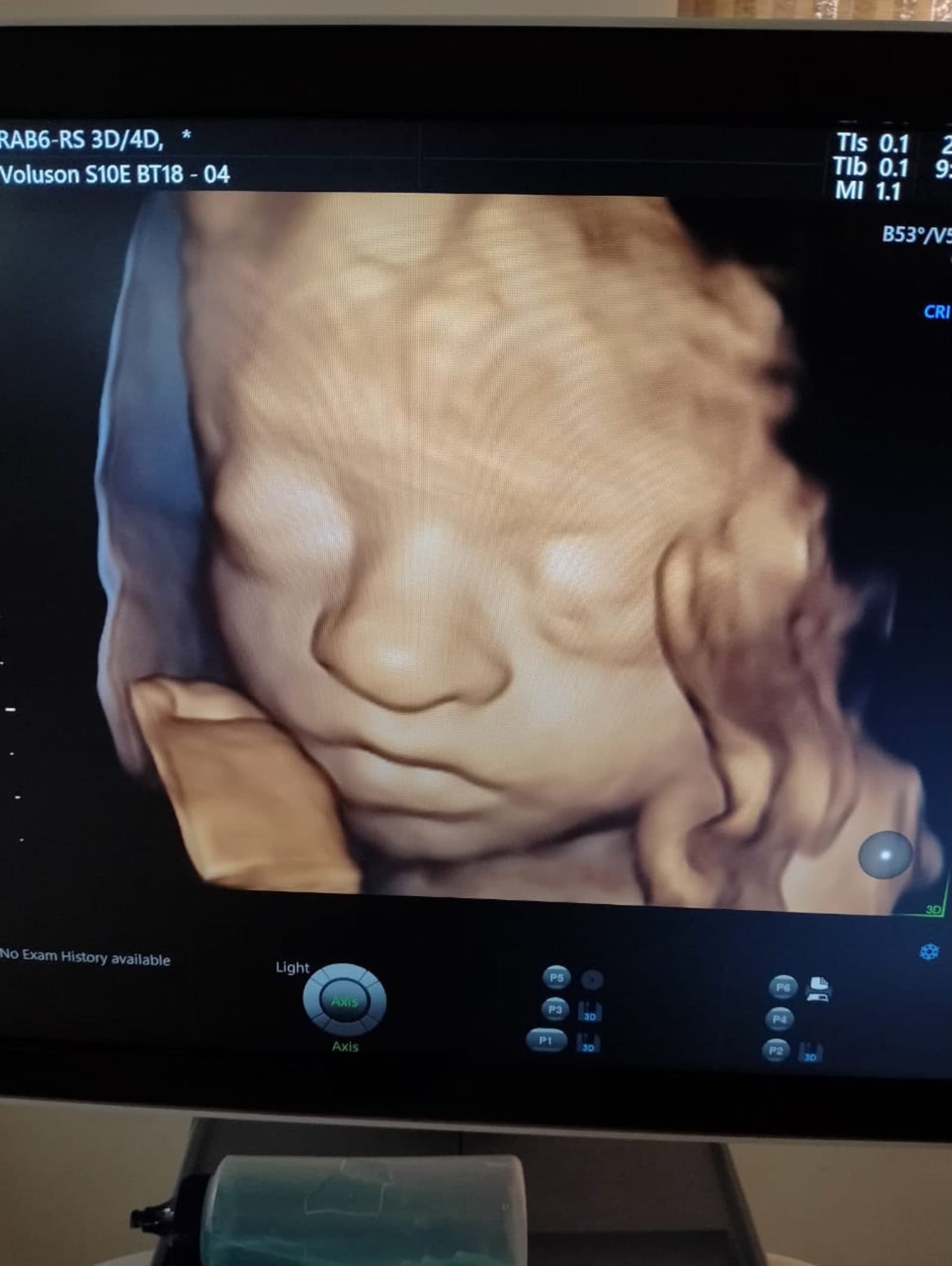 Radiology Scan